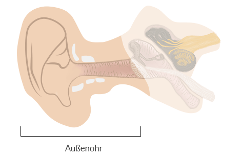 Bei einer Außenohrentzündung ist der  Gehörgang und die Ohrmuschel betroffen.