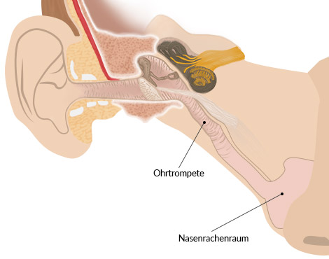 Mittelohrentzündung -  Ohrtrompete, Nasenrachenraum